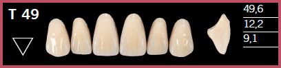 T49-D4 DELARA TEETH UPPER ANTERIOR