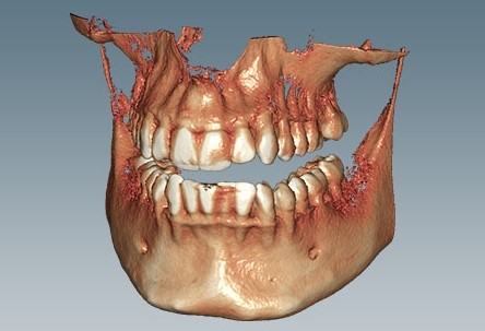 [AM179146] CERAMILL DICOM VIEWER