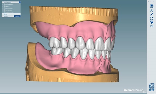 [AM179147] CERAMILL D-FLOW DENTURE SOFTWARE