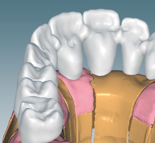 [AM179152] CERAMILL M PLANT
