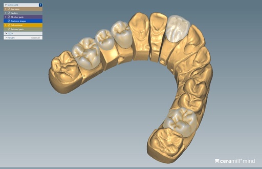 [AM179701] CERAMILL MINDFORMS CUTBACK EXTENSION