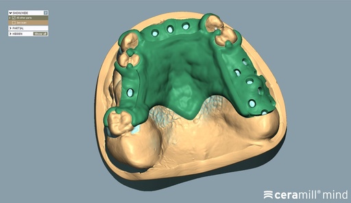 [AM179702] CERAMILL M-PART