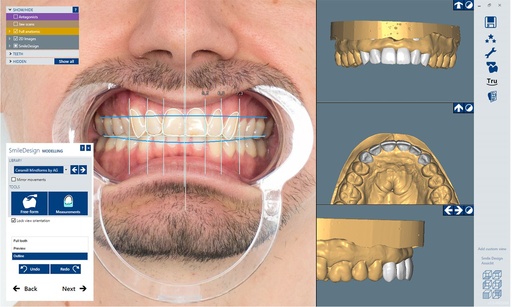 [AM179704] CERAMILL M-SMILE