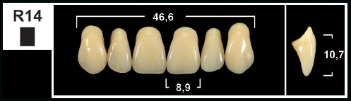 [GBR14-D4U] R14 D4 UPPER ANTERIOR TRIBOS TEETH