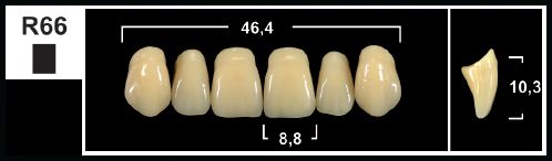 [GBR66-A1U] R66 A1 UPPER ANTERIOR TRIBOS TEETH