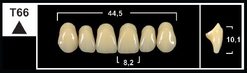 [GBT66-B1U] T66 B1 UPPER ANTERIOR TRIBOS TEETH