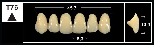 [GBT76-C2U] T76 C2 UPPER ANTERIOR TRIBOS TEETH