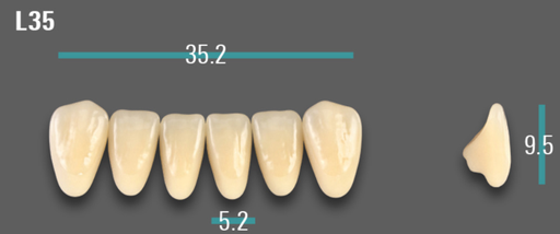 [VIABA1VL35] VITA VIONIC VIGO Anterior, A1, L35
