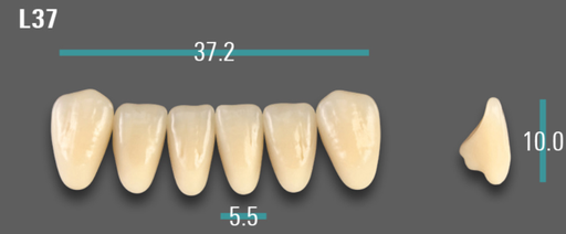 [VIABA1VL37] VITA VIONIC VIGO Anterior, A1, L37