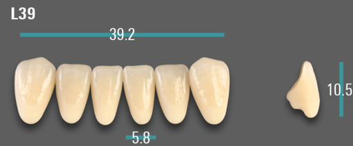 [VIABA1VL39] VITA VIONIC VIGO Anterior, A1, L39