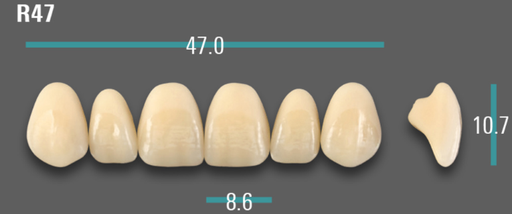 [VIABA1VR47] VITA VIONIC VIGO Anterior, A1, R47