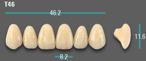 [VIABA1VT46] VITA VIONIC VIGO Anterior, A1, T46