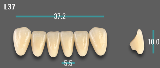 [VIABA2VL37] VITA VIONIC VIGO Anterior, A2, L37