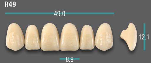 [VIABA2VR49] VITA VIONIC VIGO Anterior, A2, R49