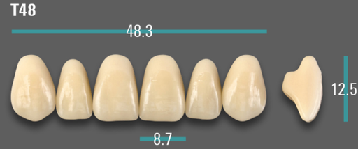 [VIABA2VT48] VITA VIONIC VIGO Anterior, A2, T48