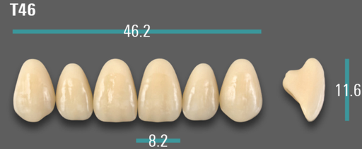 [VIABA35VT46] VITA VIONIC VIGO Anterior, A3.5, T46