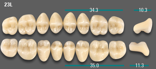 [VIABA3V23LUK] VITA VIONIC VIGO Posterior, A3, 23L UK
