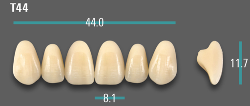 [VIABA3VT44] VITA VIONIC VIGO Anterior, A3, T44