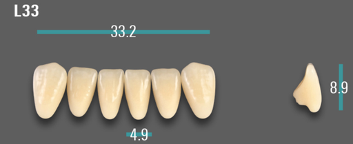 [VIABB3VL33] VITA VIONIC VIGO Anterior, B3, L33