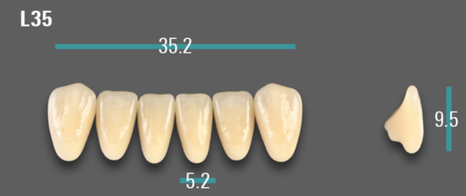 [VIABB3VL35] VITA VIONIC VIGO Anterior, B3, L35