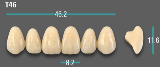 [VIABB3VT46] VITA VIONIC VIGO Anterior, B3, T46