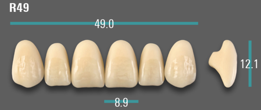[VIABD3VR49] VITA VIONIC VIGO Anterior, D3, R49